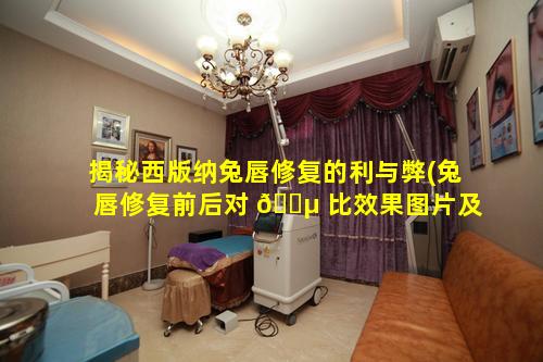 揭秘西版纳兔唇修复的利与弊(兔唇修复前后对 🌵 比效果图片及恢复过 🦟 )